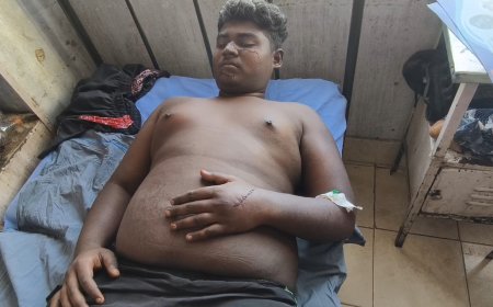 கேட்டரிங் கல்லூரி மாணவரை கத்தியால் தாக்கிய திருநங்கை.!